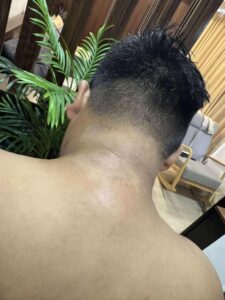 Niacinamide Soap for Eczema Relief in Mabalacat