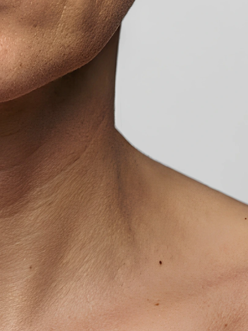 Dull-looking skin